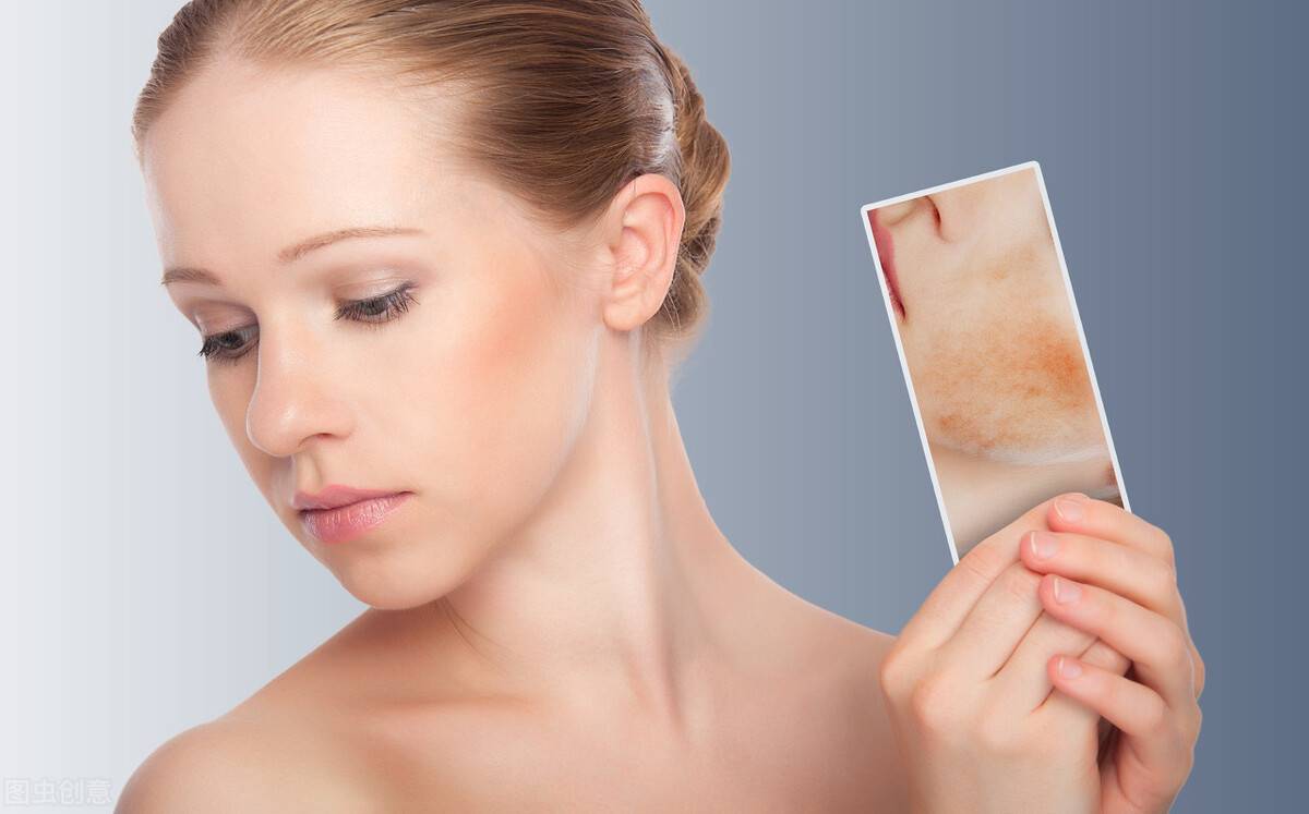Cách trị mụn ẩn nhanh, hiệu quả và an toàn cho da mặt
